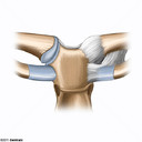 Articulacin Esternoclavicular