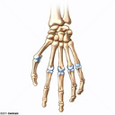 Articulación Metacarpofalángica