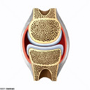 Cápsula Articular