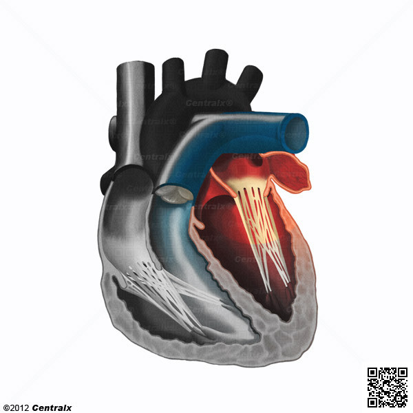 Atrial Appendage