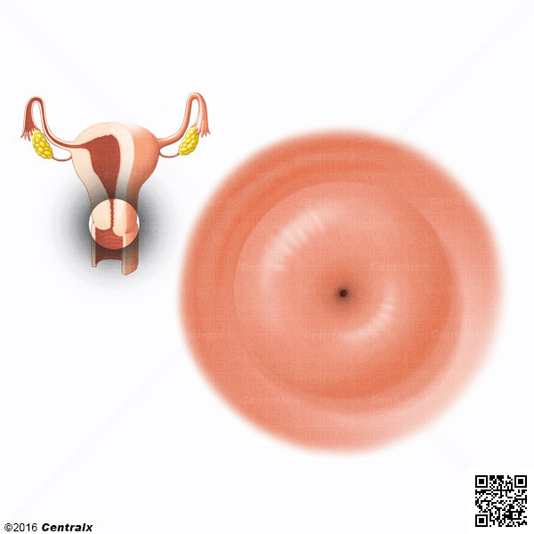 Cervix Uteri