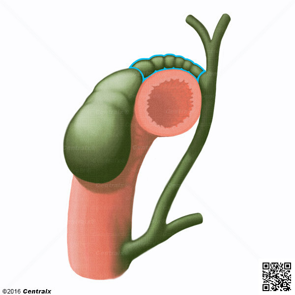 Cystic Duct
