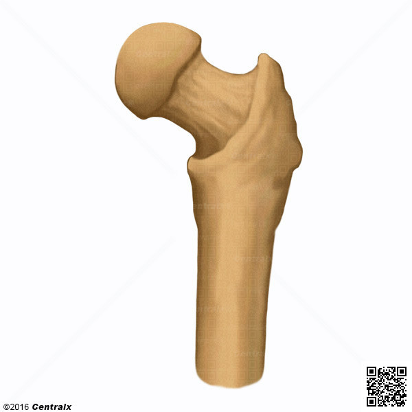 Femur Head