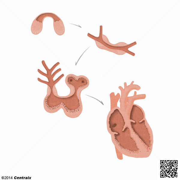 Fetal Heart