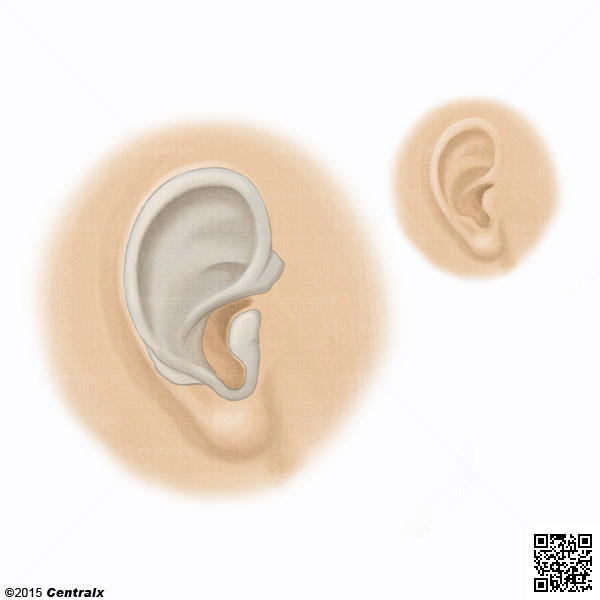 Ear Cartilage
