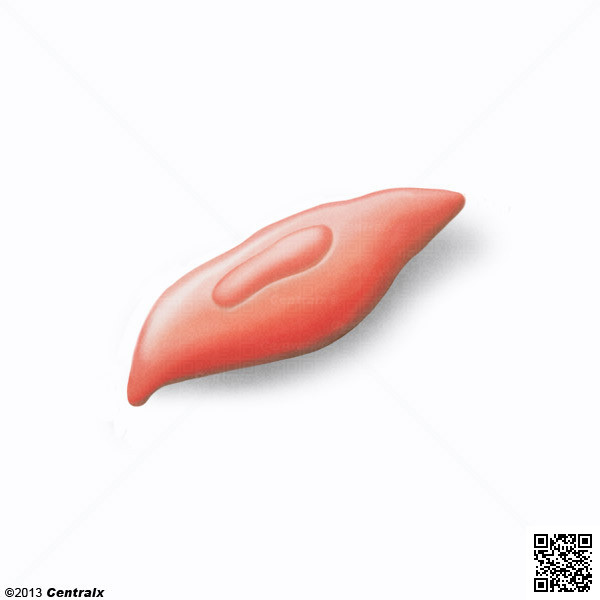 Myoblasts