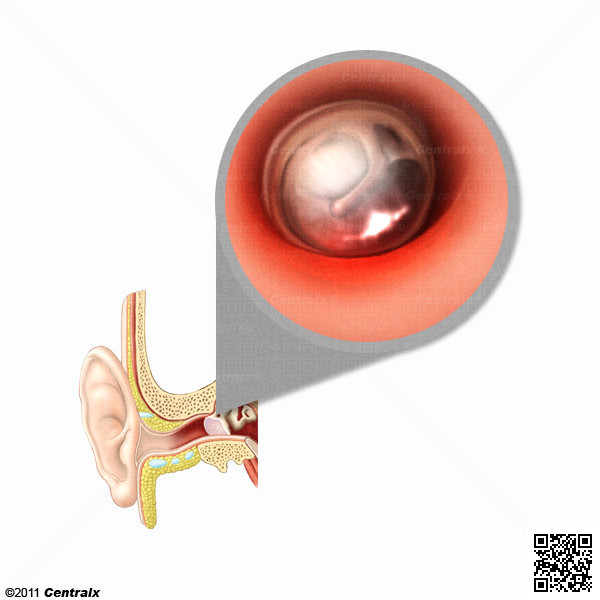 Tympanic Membrane