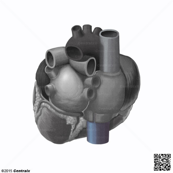 Vena Cava, Inferior