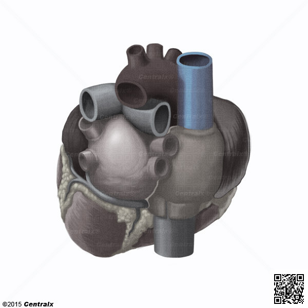 Vena Cava, Superior