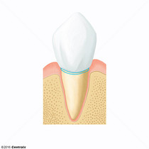 Tooth Cervix