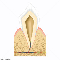 Tooth Apex