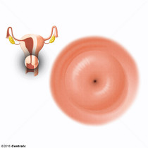 Cervix Uteri